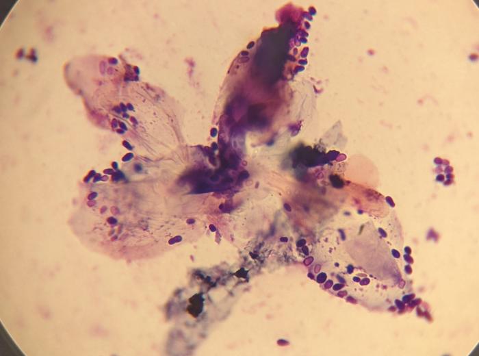 Ear Infections and Otitis Externa in Dogs
